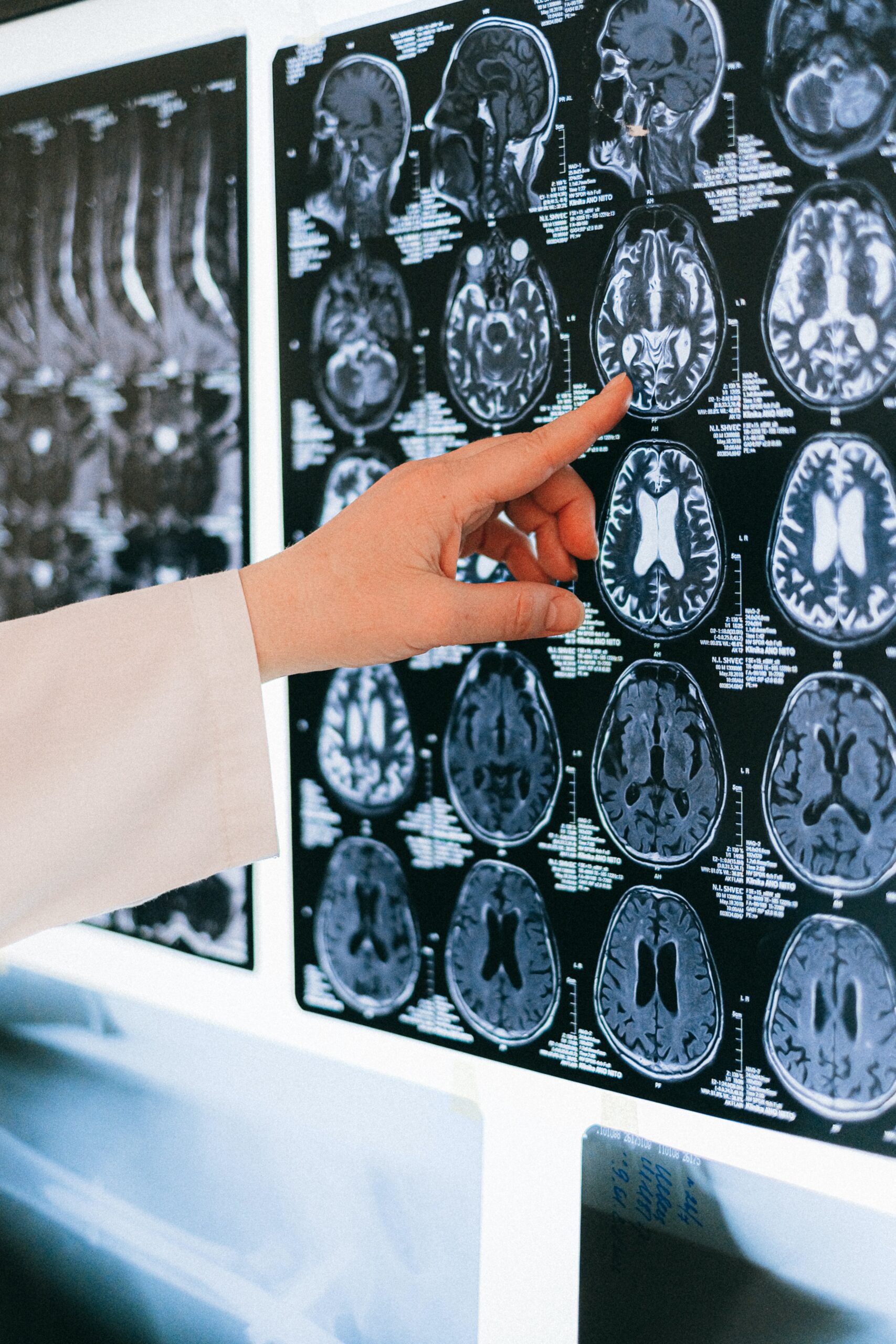Impianti cerebrali. Se l’azienda fallisce | MIT Technology Review